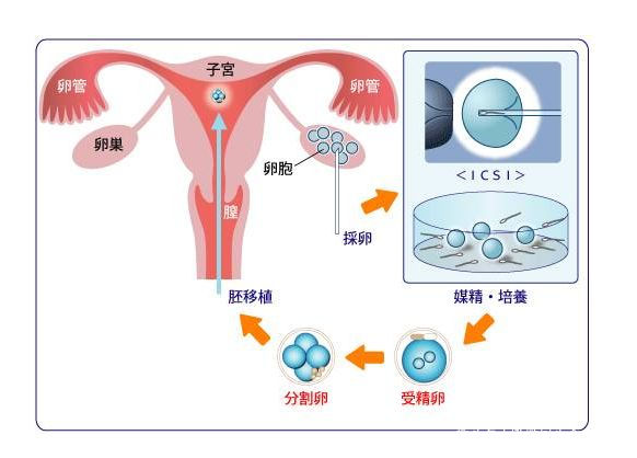 预产期