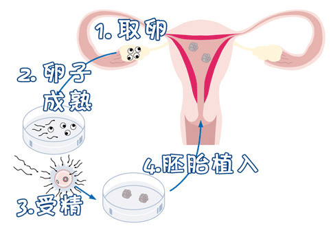 预产期