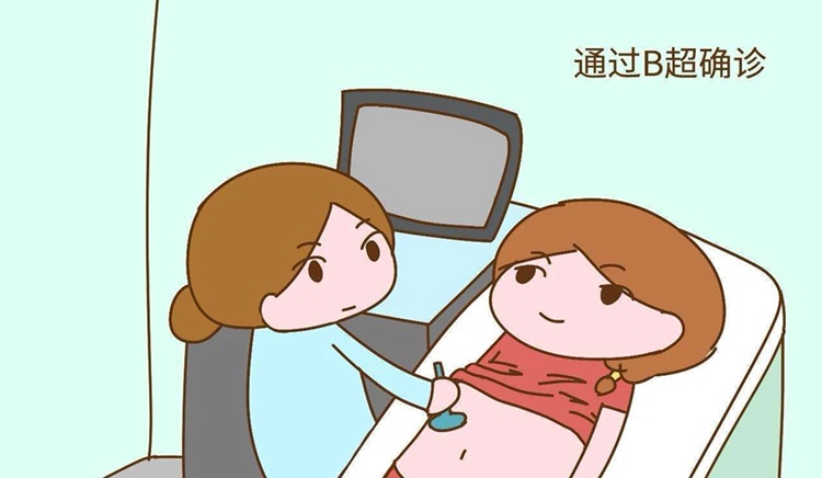 预产期
