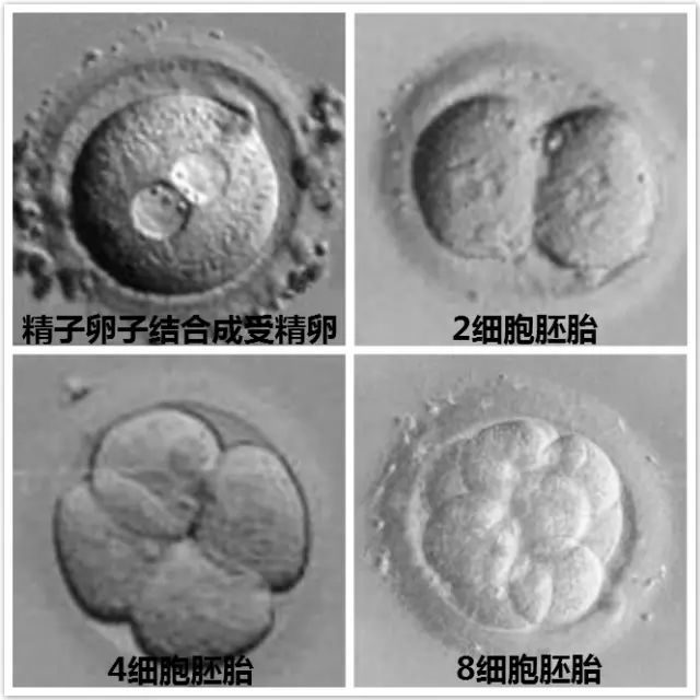 顺产