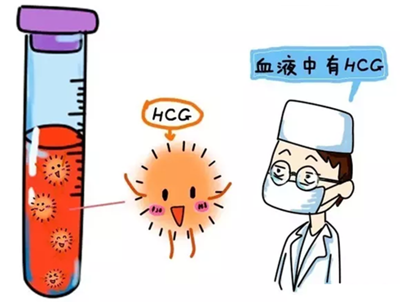 顺产