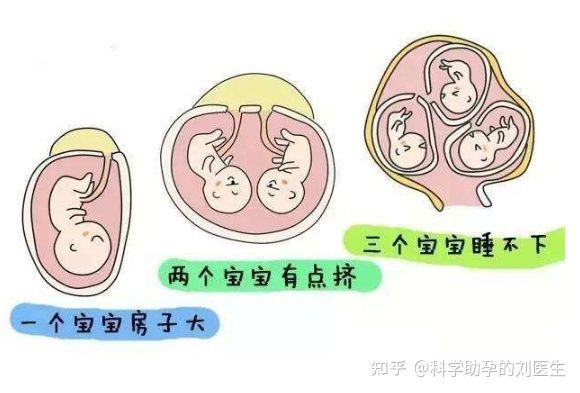 预产期