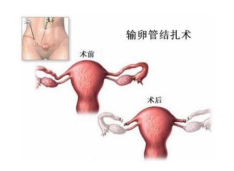 预产期