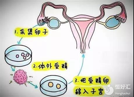 预产期