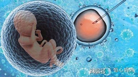 引产