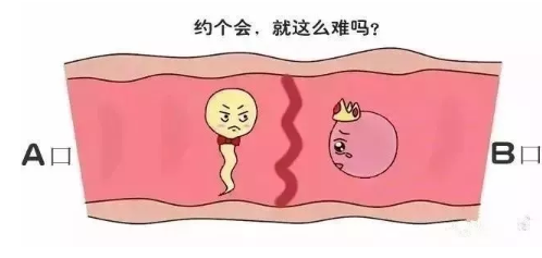 顺产
