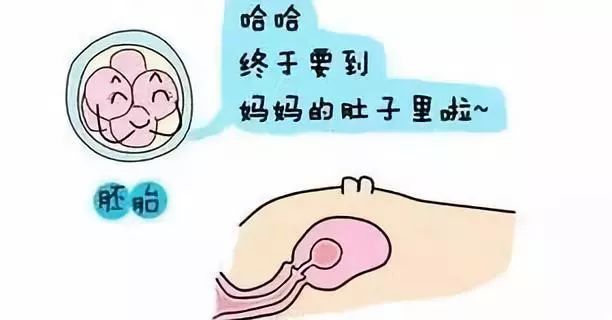 剖腹产