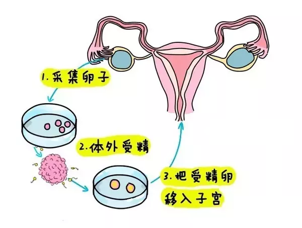 顺产