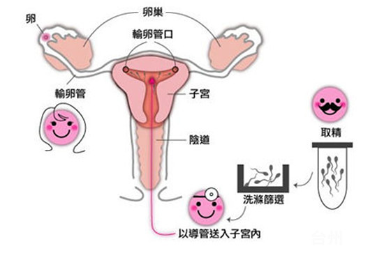 预产期