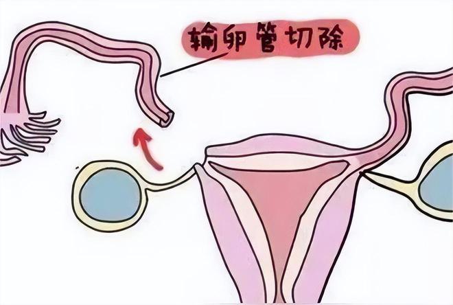 孩子出生